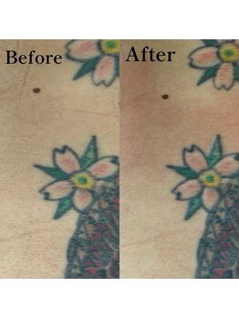 ボーホーアフロ(BOHO AFRO)/Tatoo箇所もワックスなら脱毛可