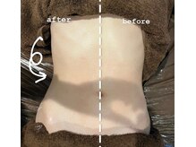 アヤエステティックサロン 綱島店(AYA)/《痩身.1》【綱島/エステ】