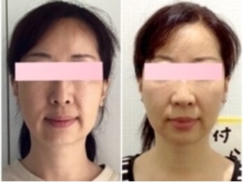 美容整体ウェリナ あま甚目寺院/小顔矯正/骨盤矯正/美脚サロン