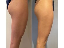 ルナグランデ(Luna grande.)/効果写真