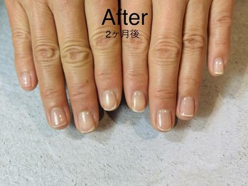 アンドネイル 海老名(&nail)/自爪育成ジェル、2ヶ月です。