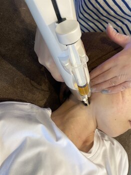 ニコホリ(NIKOHORI)/エクソリフト/フェイシャル/美肌