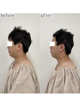 ヴェルシック(Belchic)/男性もしっかりと小顔へ導きます