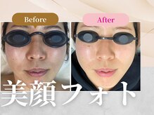 フェルナ(FERNA)/フェイシャル