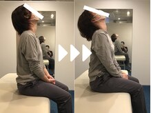 ミライズ整体院 三宮本院/事例【30代女性・首の張り】