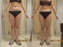 プロラボスパ 姫路店/20代後半　症例写真