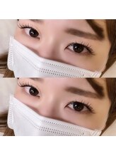 リンダ(Linda)/フラット100本