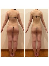 ワンモア(ONEMORE)/