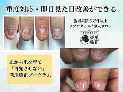 ブルームーンネイルズ(BLOOMOON.nails)の写真