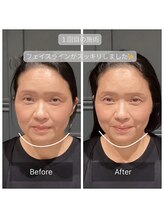 サリエ(S'allier)/お客様のビフォーアフター