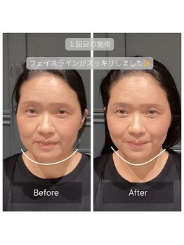 サリエ(S'allier)/お客様のビフォーアフター