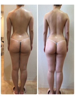 カロン(Kalon)/ブライダルエステ