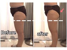 ポルトボーテ(Porte Beaute)/ヒップアップならお任せ♪