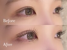 ミラ(Mila)/Before ⇒ After