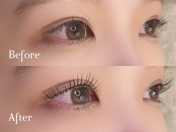 ミラ(Mila)/Before ⇒ After