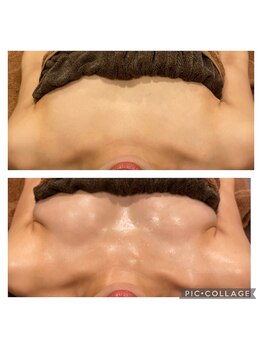 グレイス(Grace)/《大人気！》ボンボンバスト♪