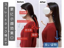 カナエル(CANAEL)の雰囲気（お首の矯正でお顔のリフトアップが更にUP!首肩凝り姿勢改善も◎）