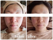 リッチフェイス 京都店(Rich Face)