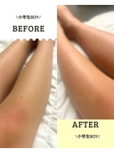 ワンダー(Wonder)/小学生もシュガーリング◎