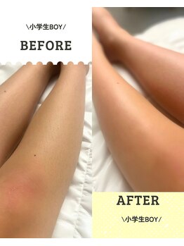 ワンダー(Wonder)/小学生もシュガーリング◎