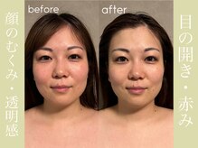 健志接骨院/πテラピー造顔メソッド　