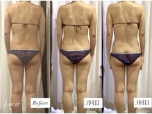 ルシール 仙台店(lucir)/【上半身集中プラン】バスト背中