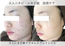 エピア 半田店(Epia)