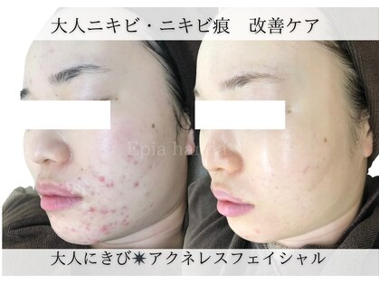 エピア 半田店(Epia)の写真