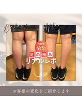 うぃず鍼灸整骨院/【足のむくみを改善】美脚施術◎