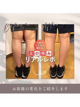 うぃず鍼灸整骨院/【足のむくみを改善】美脚施術◎