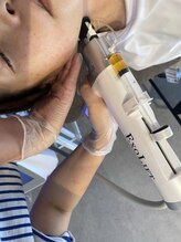 ニコホリ(NIKOHORI)/エクソリフト/フェイシャル/美肌