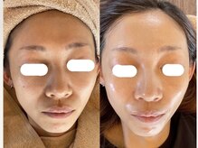 リノアンド(Lino&)/クリスティーナ：アンストレス