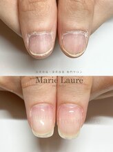 マリーロール 梅田店(Marie Laure)/自爪育成/深爪矯正/ネイルケア