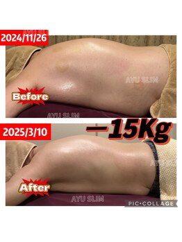 アユスリム(AYU SLIM)/短期集中ケア 充実痩身