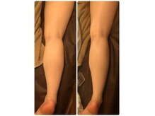 コルディ(KOLDI)の雰囲気（コルギで全身スッッキリ！）