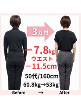 おもいやり鍼灸治療院 モーイ(mooi)/鍼灸痩身ダイエット