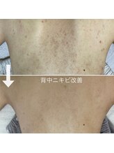 シェノン 赤坂大濠店/