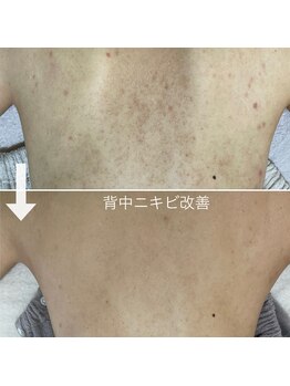 シェノン 赤坂大濠店/