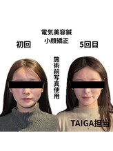 クリアランス(CLEARANCE)/施術回数5回　TAIGA担当