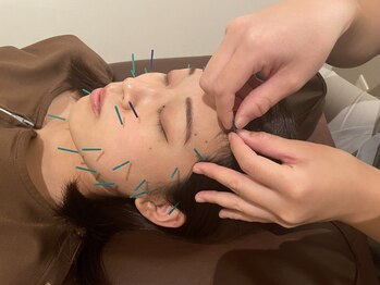 健康堂 整体整骨院 戸越銀座院/美容鍼もやってます！