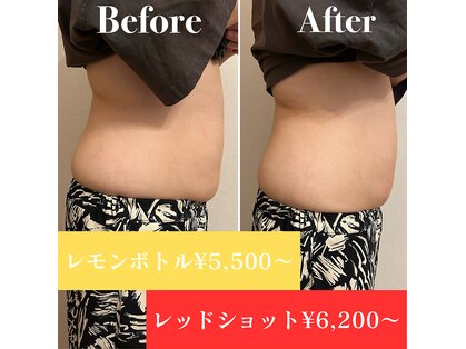 ヴィアージュ(Viage)の写真