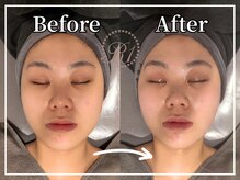 R-1ビューティーサロン 銀座/Before＆After