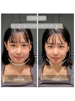 サリエ(S'allier)/お客様のビフォーアフター