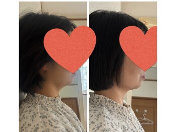 ララ(Rala)/全身骨格調整+小顔調整