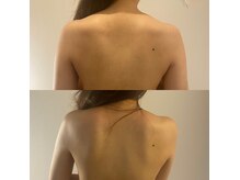 ココフルール(Cocofleur)の雰囲気（アロマリンパマッサージで首肩こり/腰痛/むくみも改善！）