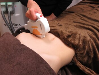 ミオ(mio)/高性能脱毛器採用♪