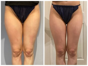 ルナグランデ(Luna grande.)/隙間発見!