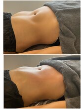 ウル(Ulu)/腸もみビフォーアフター