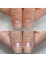 リラフ(Re:laugh)/ネイルケア/ハンドケア/爪育