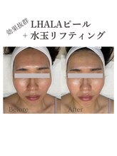 フォルディオ(FORDIO)/ララピールx水玉リフティング